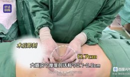 爆料桂哥抽脂视频教程,轻松掌握塑形技巧